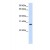 Western Blot: HSD11B1 Antibody [NBP1-69644] - This Anti-HSD11B1 antibody was used in Western Blot of Fetal Liver tissue lysate at a concentration of 1ug/ml.